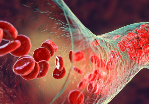 Understanding the Increased Risk of Blood Clots with HRT Therapy